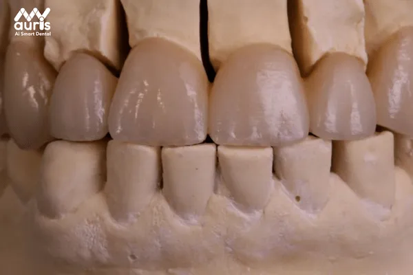 Răng toàn sứ cao cấp Zirconia
