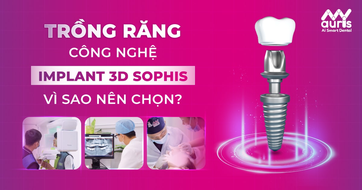 trồng răng công nghệ implant 3d sophis