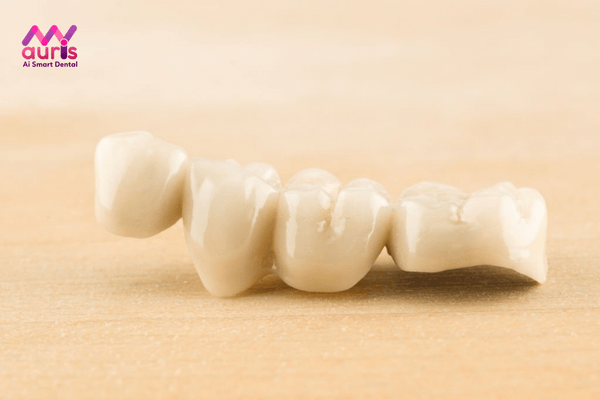 Trồng răng giả bao nhiêu tiền bằng cầu răng sứ?