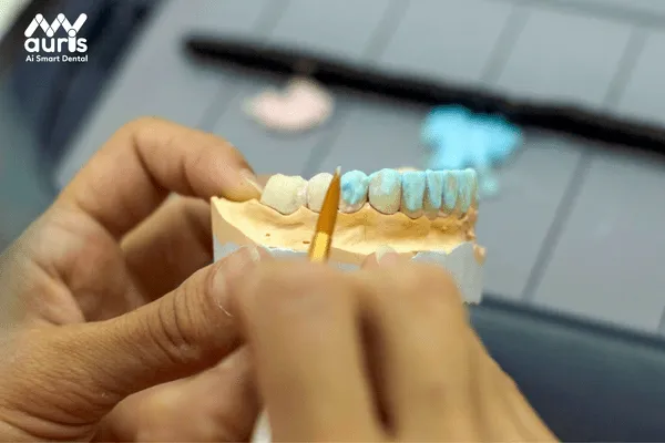 Giá phục hình răng sứ trên Implant