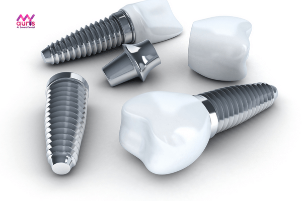 trồng răng implant giá bao nhiêu 1 cái