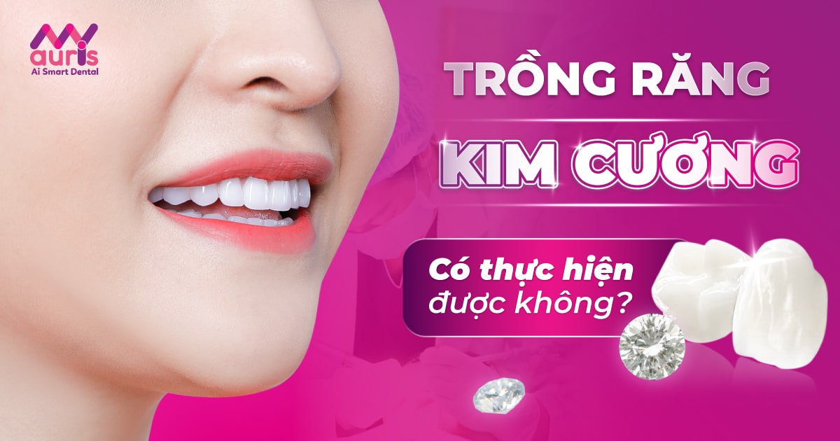 trồng răng kim cương