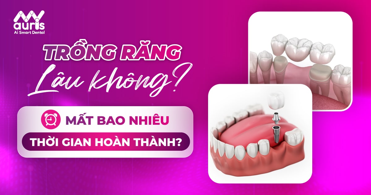 trồng răng lâu không