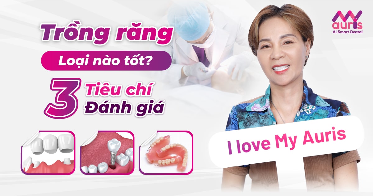 Trồng răng loại nào tốt