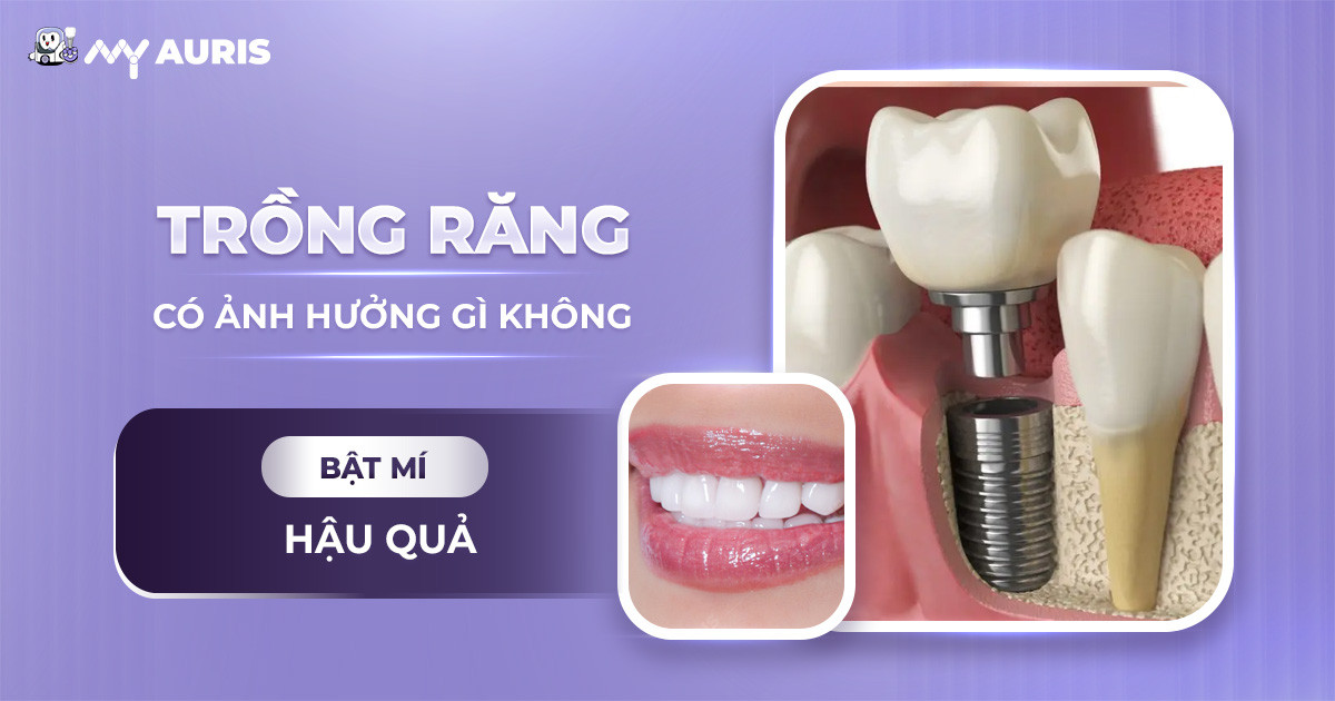 trồng răng sứ có ảnh hưởng gì không,trồng răng sứ có bền không,trồng răng sứ có tốt không