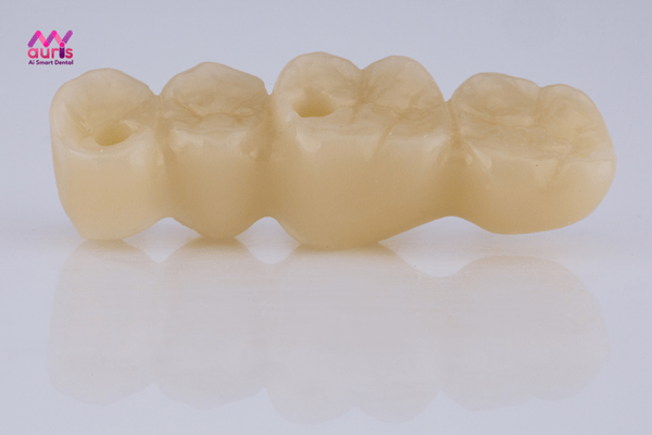 Răng sứ không kim loại cercon 