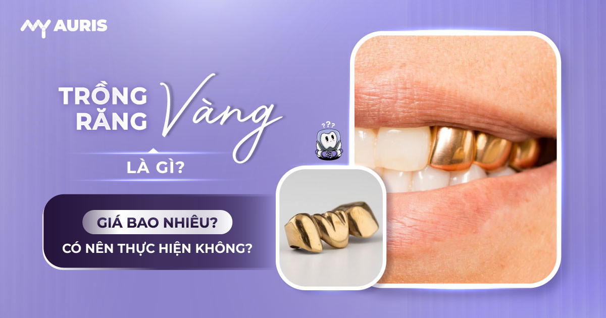 trồng răng vàng,trồng răng hàm vàng