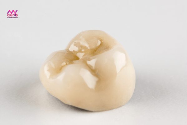 Giá răng sứ thẩm mỹ phục thuộc vào chất lượng, vật liệu răng sứ 