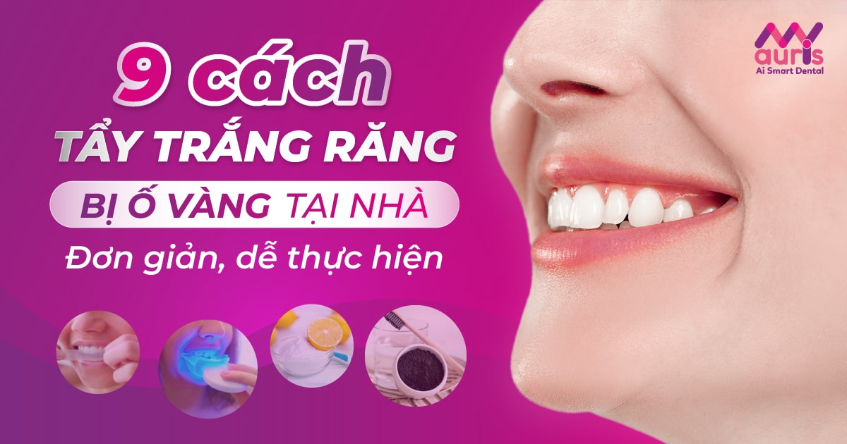 9 cách tẩy trắng răng bị ố vàng tại nhà