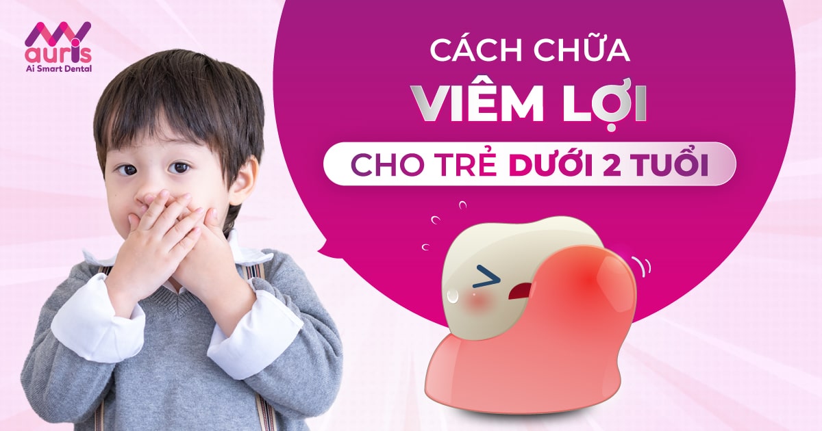 Viêm lợi là gì?
