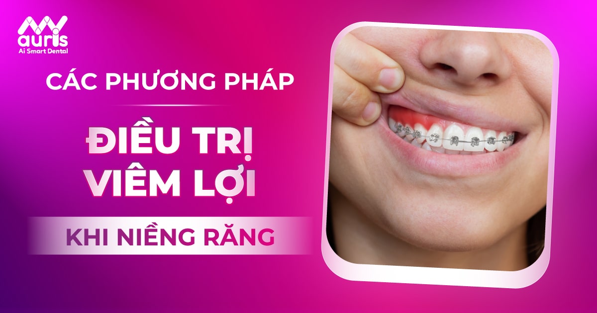 Tác động của viêm nướu đến quá trình niềng răng và kết quả cuối cùng?
