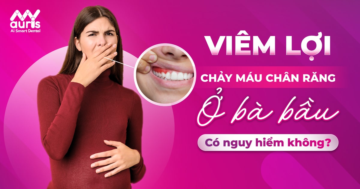 cách trị viêm lợi khi niềng răng