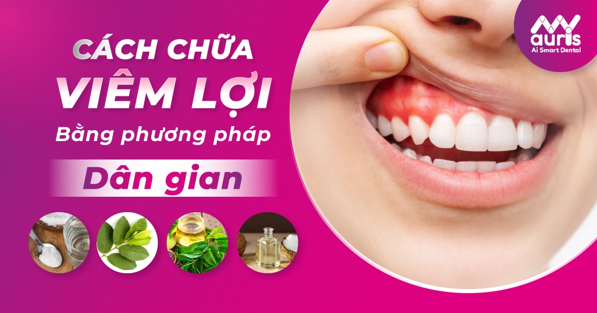 cách chữa viêm lợi bằng dân gian