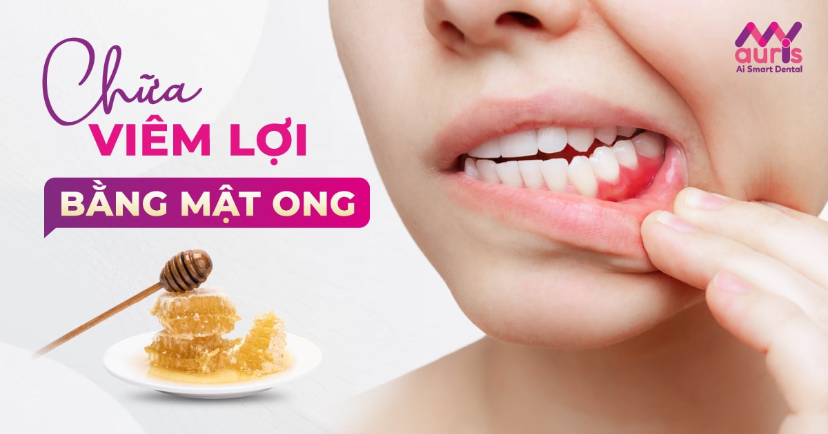 Mật ong có hiệu quả trong việc giảm đau rát do viêm lợi không?
