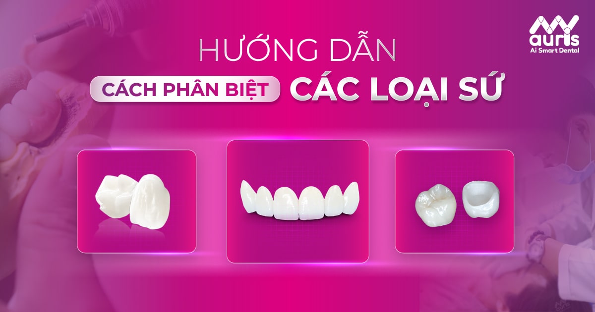 cách phân biệt các loại răng sứ