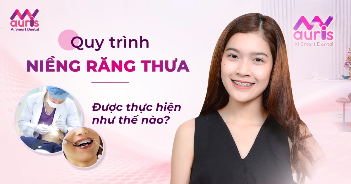 quy trình niềng răng thưa