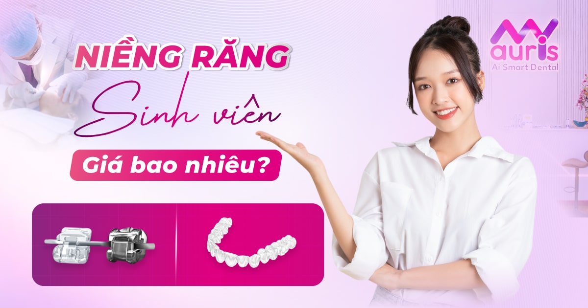 niềng răng giá sinh viên