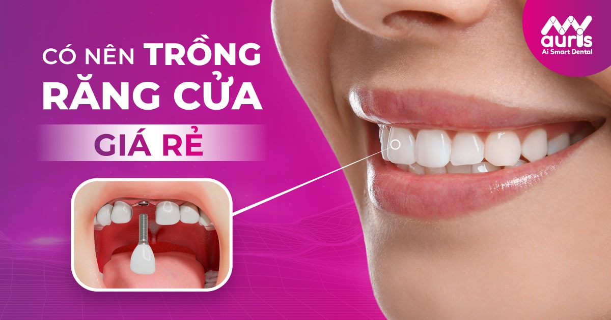 trồng răng cửa giá rẻ