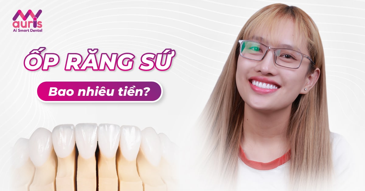 ốp răng sứ bao nhiêu tiền