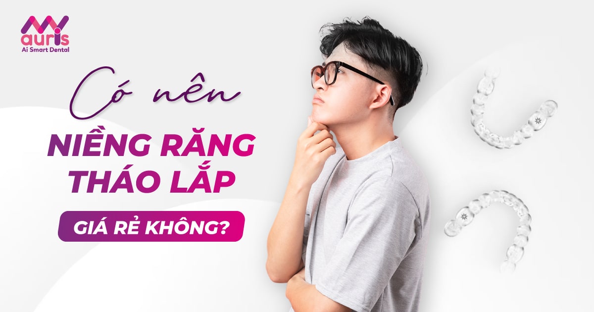 niềng răng tháo lắp giá rẻ