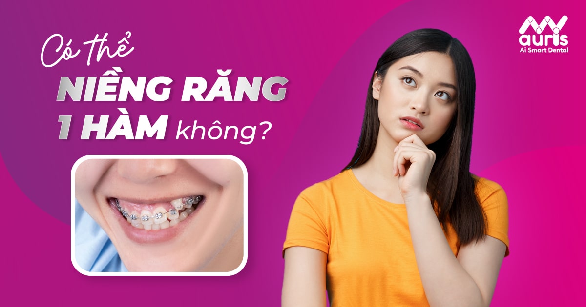 có thể niềng răng 1 hàm không