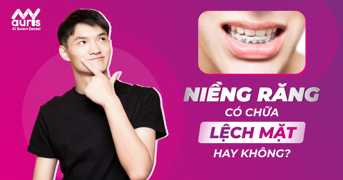 niềng răng có chữa được mặt lệch