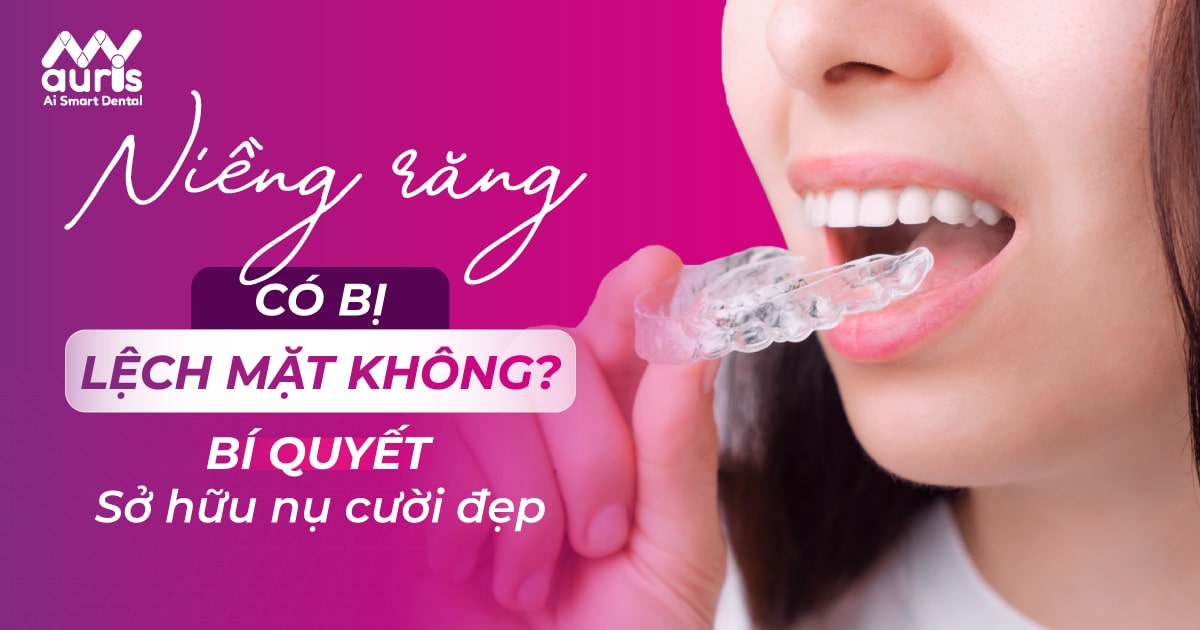 niềng răng có bị lệch mặt không