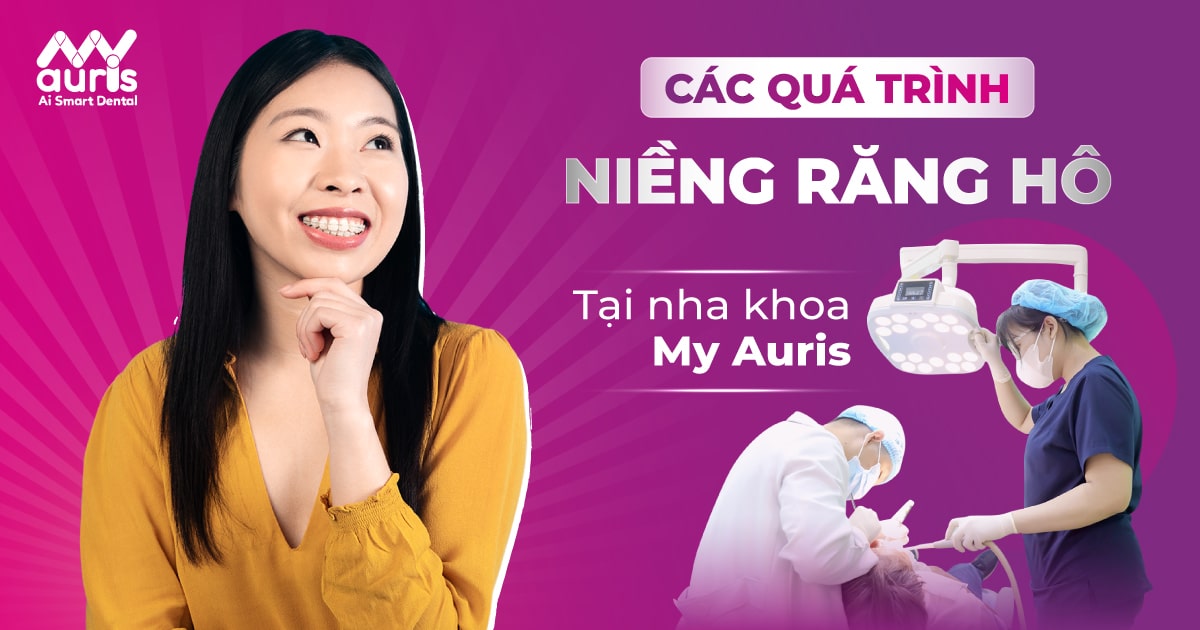 các giai đoạn của quá trình niềng răng hô