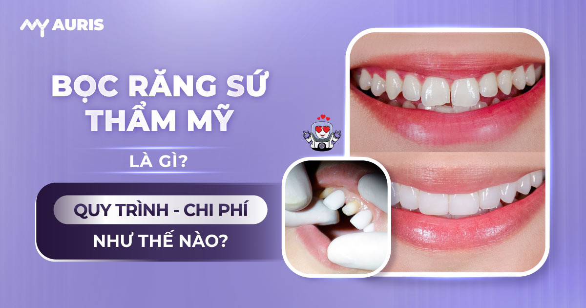 bọc răng sứ thẩm mỹ,bọc răng sứ,răng sứ,làm răng sứ thẩm mỹ,quy trình bọc răng sứ thẩm mỹ