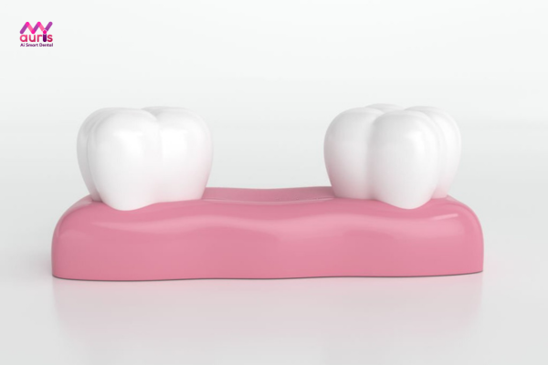 Mất răng hàm ảnh hưởng như thế nào?