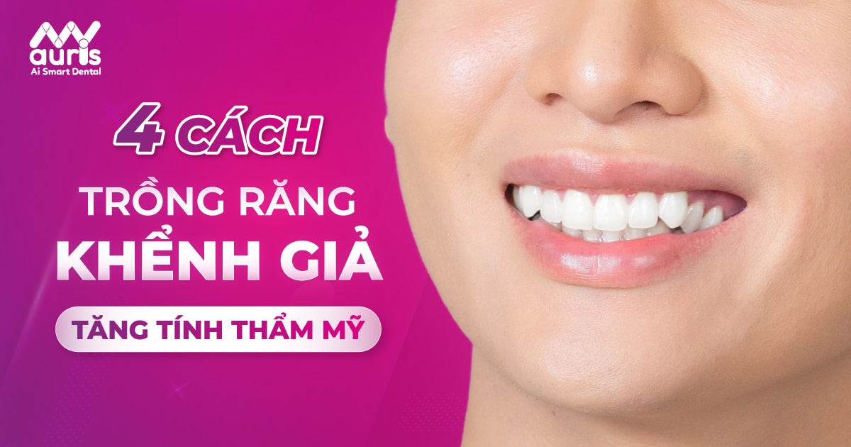 4 cách trồng răng khểnh giả