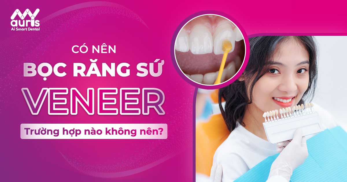 Có nên bọc răng sứ veneer