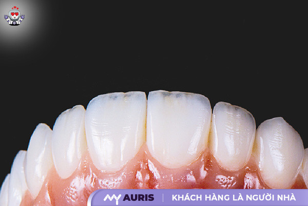 bảng giá răng sứ ht smile,giá răng sứ ht smile,răng sứ ht smile giá bao nhiêu