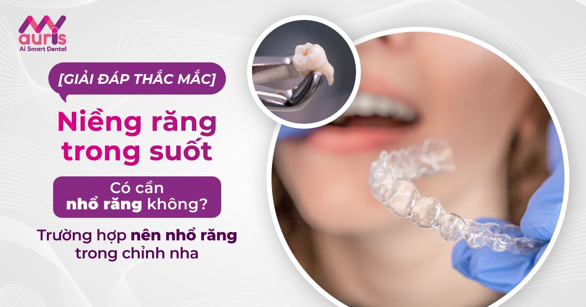 Niềng răng trong suốt có cần nhổ răng không?