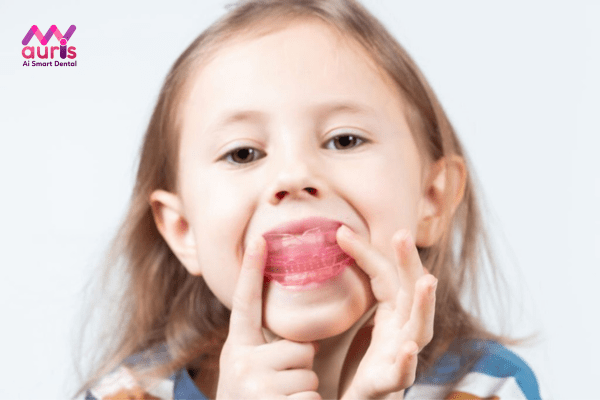 Tìm hiểu hàm tùy chỉnh niềng răng tại nhà có tốt không?