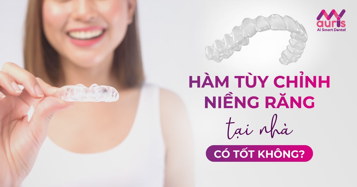 Hàm tùy chỉnh niềng răng tại nhà có tốt không? (5 ưu điểm chính)