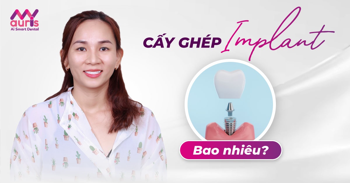 Cấy ghép Implant mất bao nhiêu tiền? (Chi tiết từ 9 triệu)