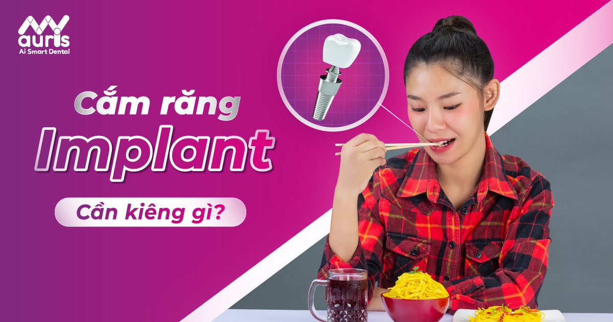 Kiêng gì khi cắm răng Implant và 5 lưu ý cần biết