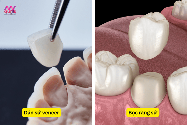 Tìm hiểu về phương pháp làm răng sứ