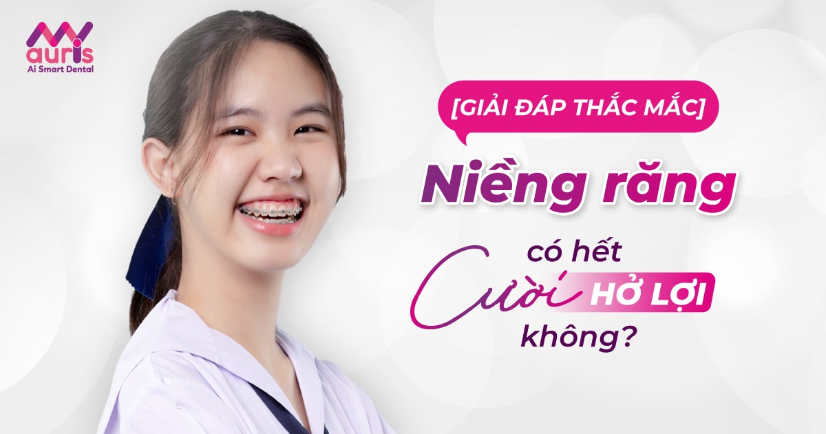 Niềng răng có hết cười hở lợi không?