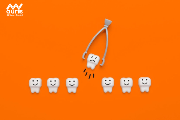 Hỏi đáp niềng răng hô nhẹ có phải nhổ răng không?