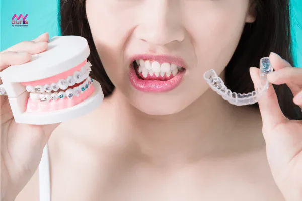 Đánh giá hiệu quả giữa niềng răng mắc cài và niềng răng trong suốt