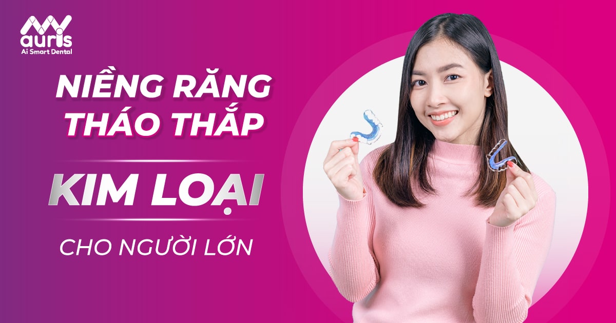 Niềng răng tháo lắp kim loại cho người lớn (Quy trình 5 bước)