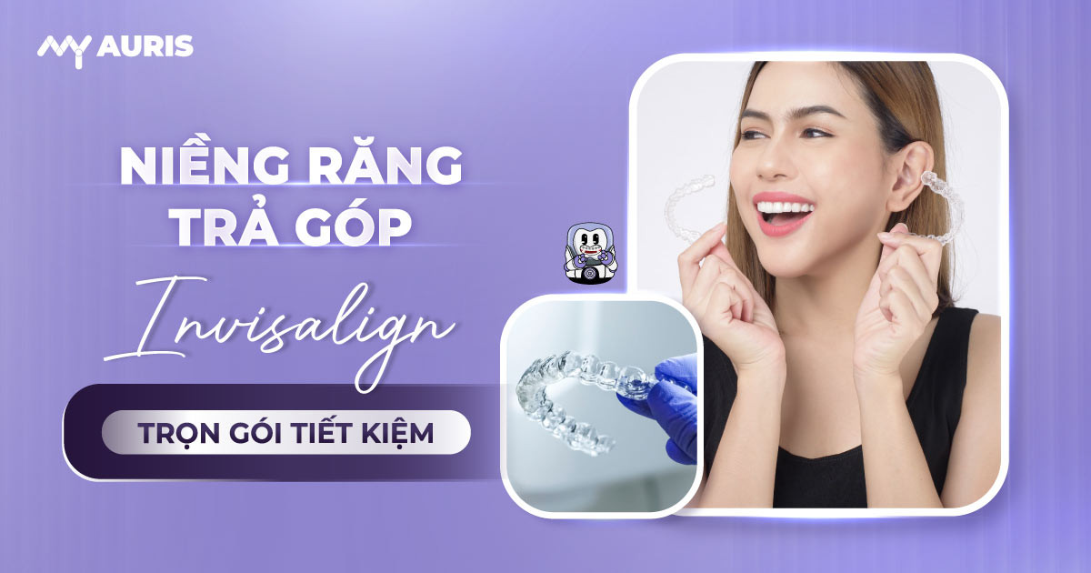 niềng răng bằng khay trong suốt