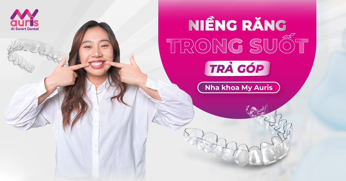 Niềng răng trong suốt trả góp uy tín - 3 câu hỏi phổ biến