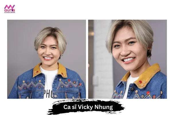 Ca sĩ Vicky Nhung - Sao việt làm răng sứ ở đâu?
