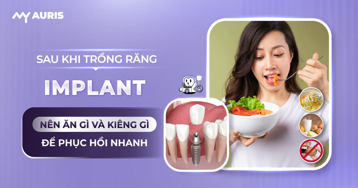 sau khi trồng răng implant nên ăn gì,ăn gì sau khi cấy implant,ăn uống sau khi cấy implant,cắm implant xong kiêng ăn gì,cấy implant xong nên ăn gì,sau khi cắm implant nên ăn gì,sau khi cấy implant nên ăn gì,trồng răng implant ăn gì,trồng răng implant có ăn được thịt gà không,trồng răng implant có kiêng ăn gì