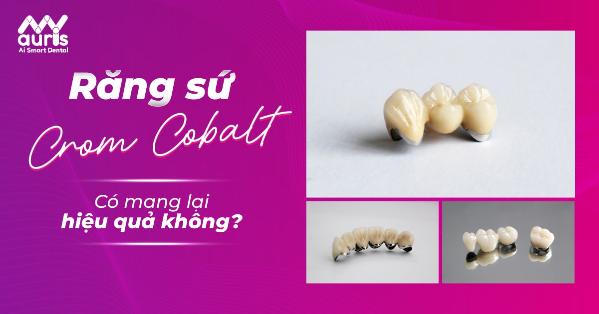 Răng sứ Crom Cobalt có mang lại HIỆU QUẢ như mong đợi?