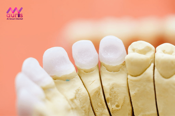 Một số dòng răng toàn sứ tham khảo