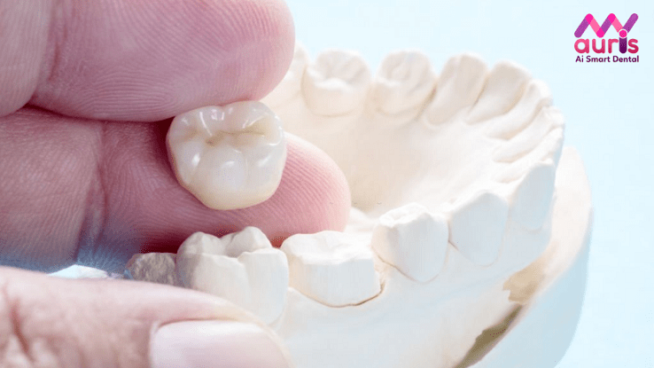 tìm hiểu về các loại răng sứ